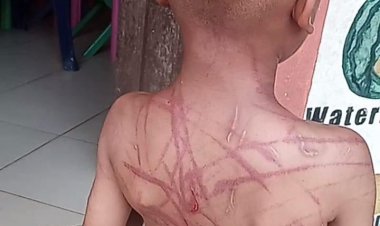 5 year Old Beaten up by Aunt, Boyfriend Over Claims he Spoilt Something In Boyfriend's Car