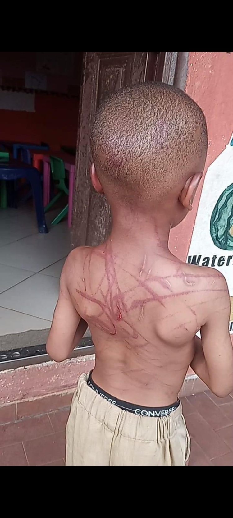 5 year Old Beaten up by Aunt, Boyfriend Over Claims he Spoilt Something In Boyfriend's Car