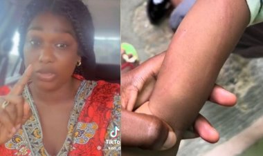 Outrage Erupts as Teacher in Nigerian School Allegedly Beats 2-Year-Old for Pooping on Herself