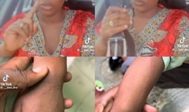 Outrage Erupts as 2-Year-Old Child Brutally Beaten by School Nanny for Accidental Soiling