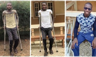 Nigerian Student Battling Sickle Cell Disease Seeks Financial Assistance from Femi Otedola
