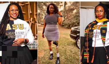 Determined Lady Overcomes Loss of Both Legs to Achieve Milestone as First Medical Doctor with a Disability in the US