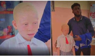 Young albino girl whose parent stopped from going to school for 4 years gets scholarship from a generous Nigerian man