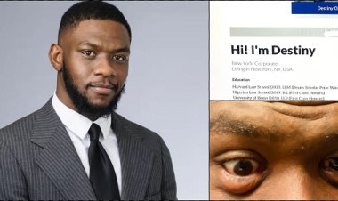 Man shares condition of his eyes after studying 13 hours daily while preparing for bar exams
