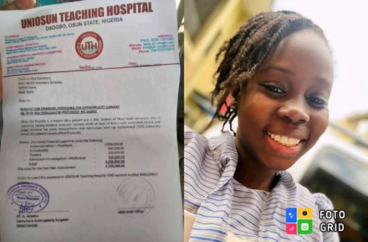 Uni-Osun Student Battling Avascular Necrosis Appeals for Financial Aid