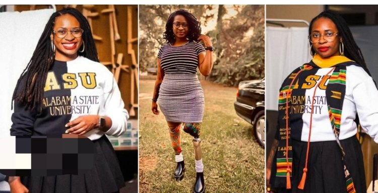 Determined Lady Overcomes Loss of Both Legs to Achieve Milestone as First Medical Doctor with a Disability in the US