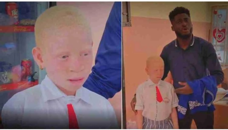 Young albino girl whose parent stopped from going to school for 4 years gets scholarship from a generous Nigerian man