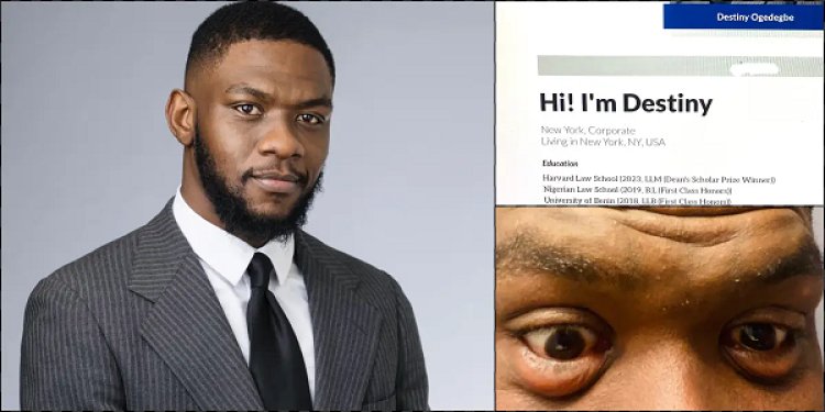 Man shares condition of his eyes after studying 13 hours daily while preparing for bar exams