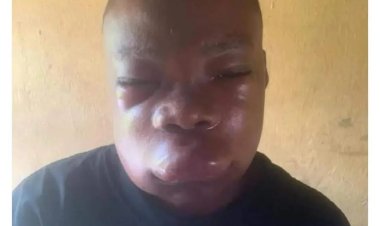 Tension at ABSU as Security Officer Brutalizes First Year Female Student