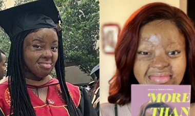 ICYMI: Plane Crash Survivor Kechi Okwuchi Earns MBA with Distinction