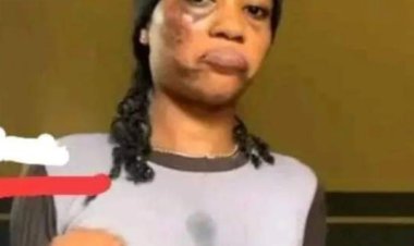 Roommate Pours Hot Water on Friend After Incident Concerning Boyfriend