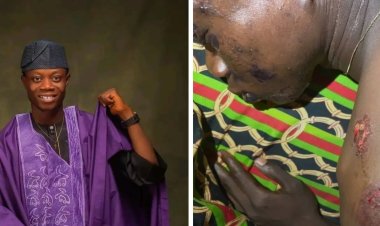 Federal Polytechnic Offa Student Survives Near-Death Accident