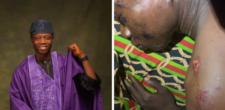 Federal Polytechnic Offa Student Survives Near-Death Accident