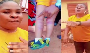 Outrage as Teacher Allegedly Beats 3-Year-Old, Leaving Her Bruised and Unable to Walk