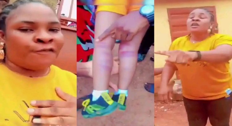 Outrage as Teacher Allegedly Beats 3-Year-Old, Leaving Her Bruised and Unable to Walk